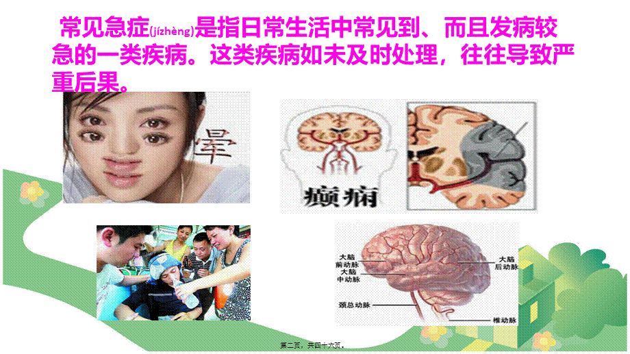 2022年医学专题—昏迷病人的救护与处理全解(1).ppt_第2页