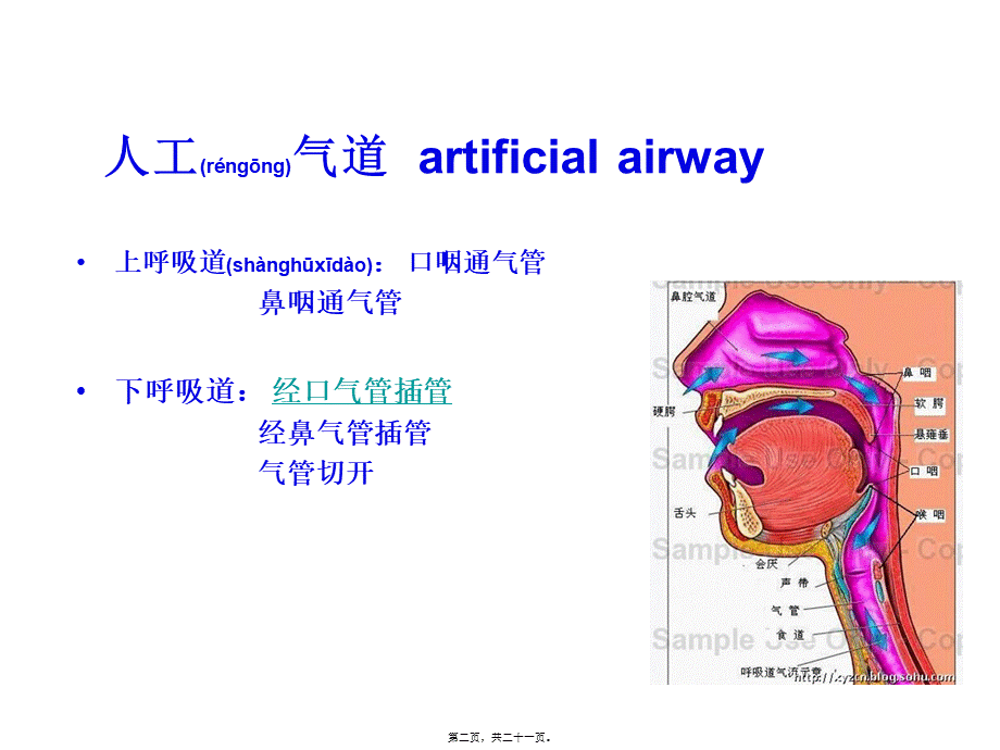 2022年医学专题—口咽通气管(1).ppt_第2页