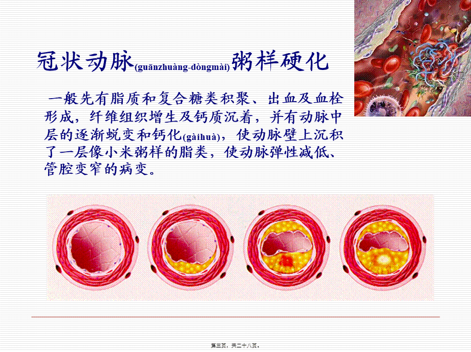 2022年医学专题—第二十二章-抗心绞痛药(1).ppt_第3页