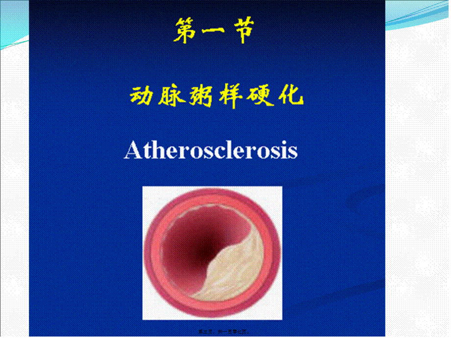 2022年医学专题—动脉粥样硬化和高血压(1).ppt_第3页