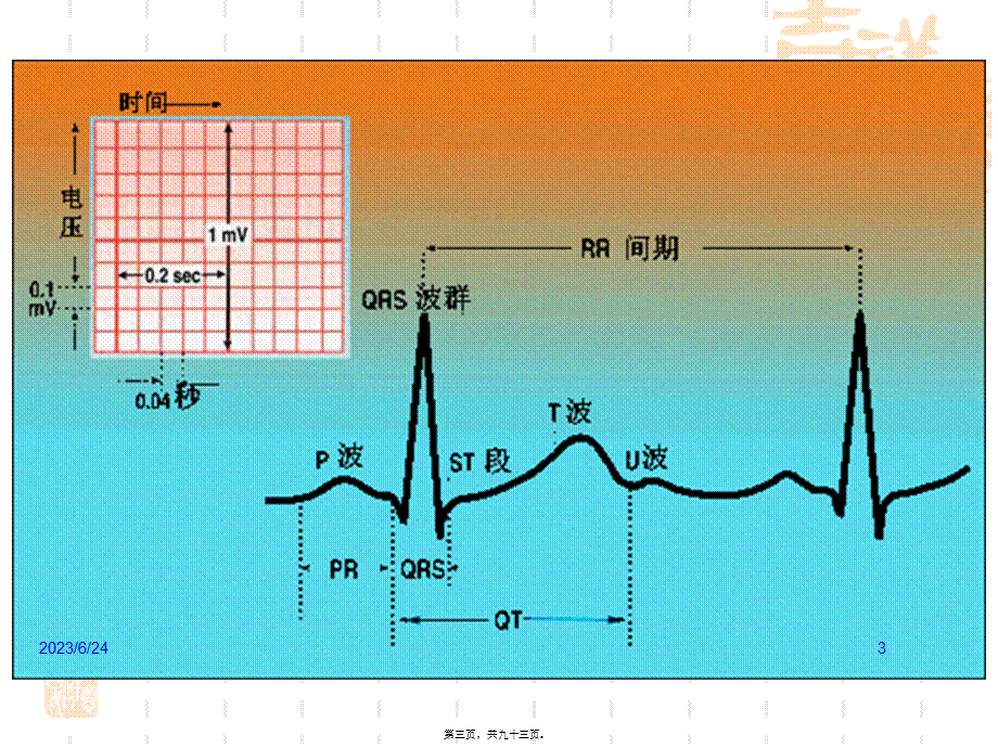 2022年医学专题—抗心律失常药(杨09-10)(1).ppt_第3页