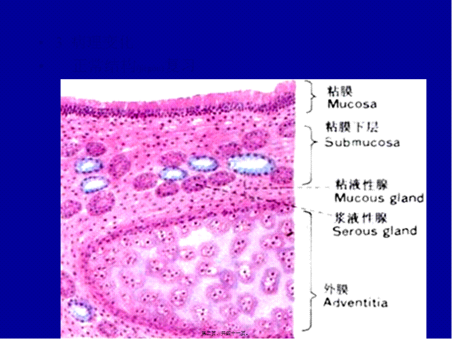 2022年医学专题—第二十一篇-慢支炎—呼(1)(1).ppt_第2页