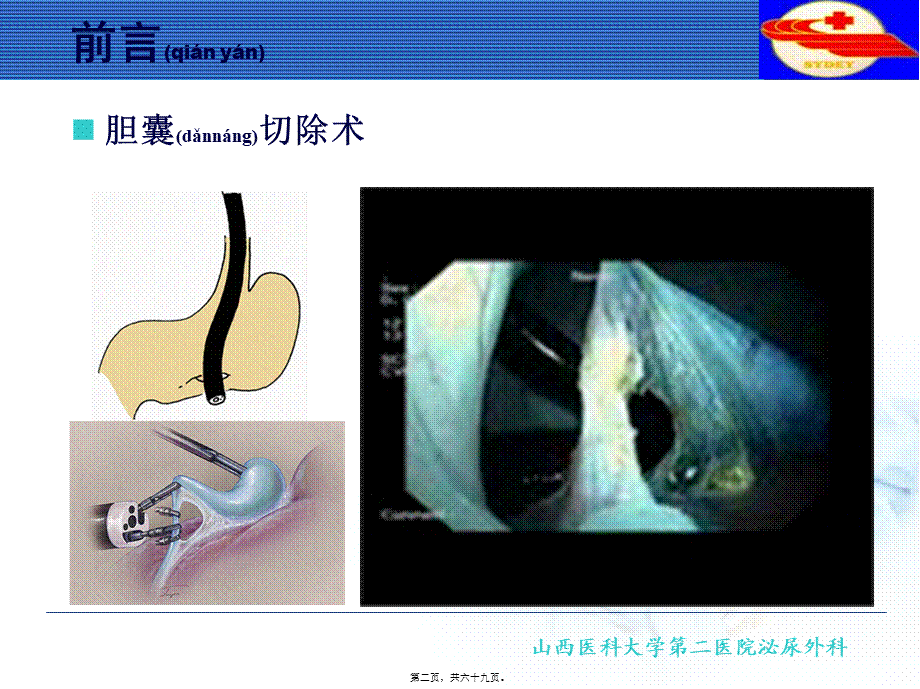 2022年医学专题—NOTES经自然腔道内镜手术(1).ppt_第2页