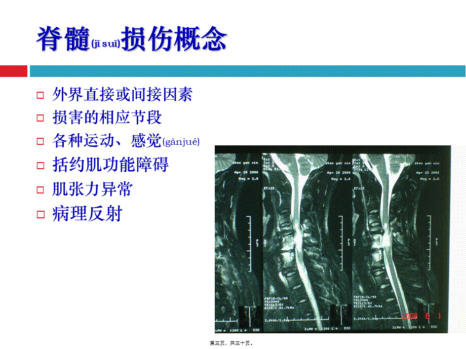 2022年医学专题—脊髓损伤概述(1).ppt_第3页