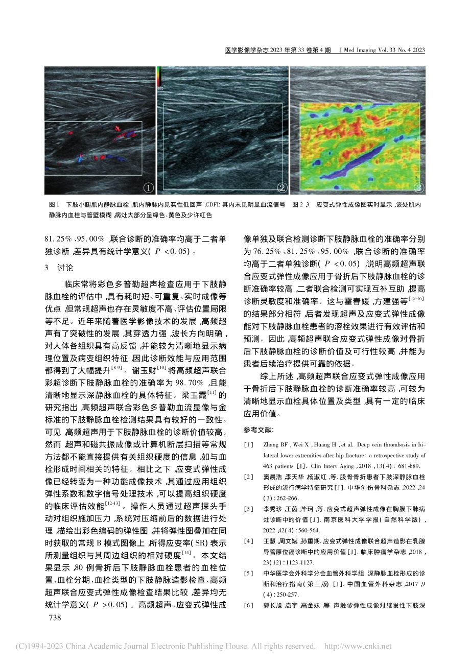 高频超声及应变式弹性成像诊...折后下肢静脉血栓的临床价值_侯宇.pdf_第3页