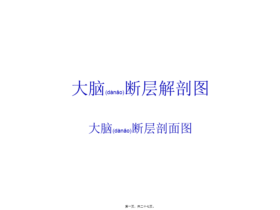 2022年医学专题—大脑结构图图例(1).ppt_第1页