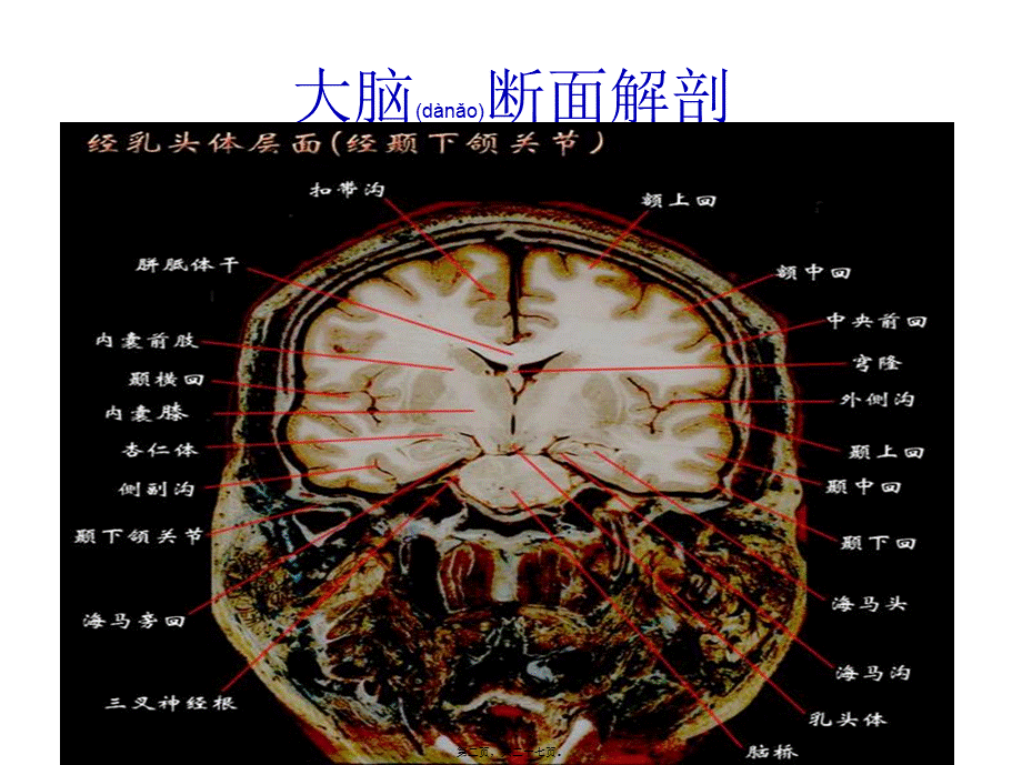 2022年医学专题—大脑结构图图例(1).ppt_第2页