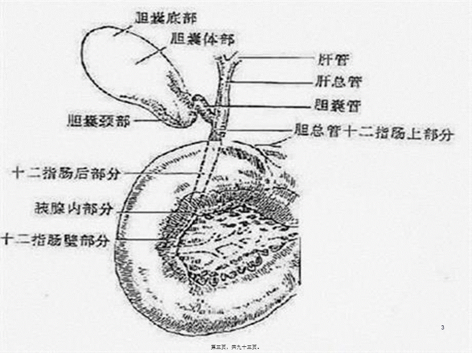 2022年医学专题—胆-系-结-石-和-感-染(1).ppt_第3页