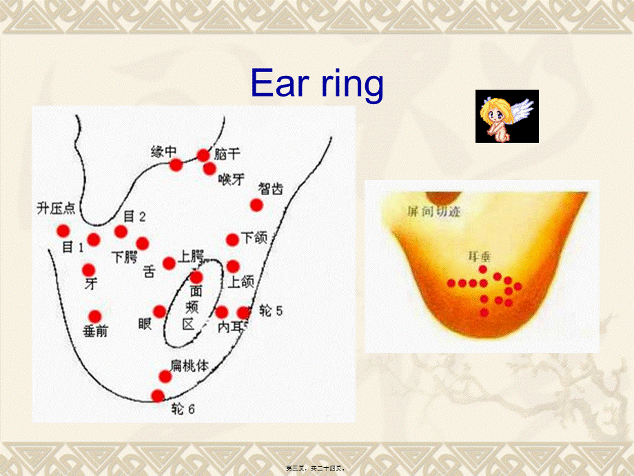 2022年医学专题—耳穴英文ppt(1).ppt_第3页