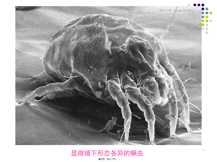 2022年医学专题—皮肤感染为主的疫病-模块二-螨病(1).ppt_第3页