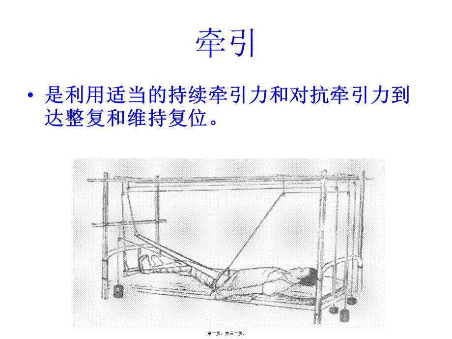 如小儿股骨干骨折用垂直悬吊皮牵引(1).pptx_第1页