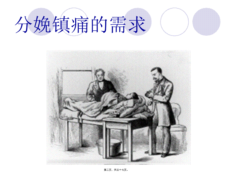 分娩镇痛协调和实施(1).pptx_第2页