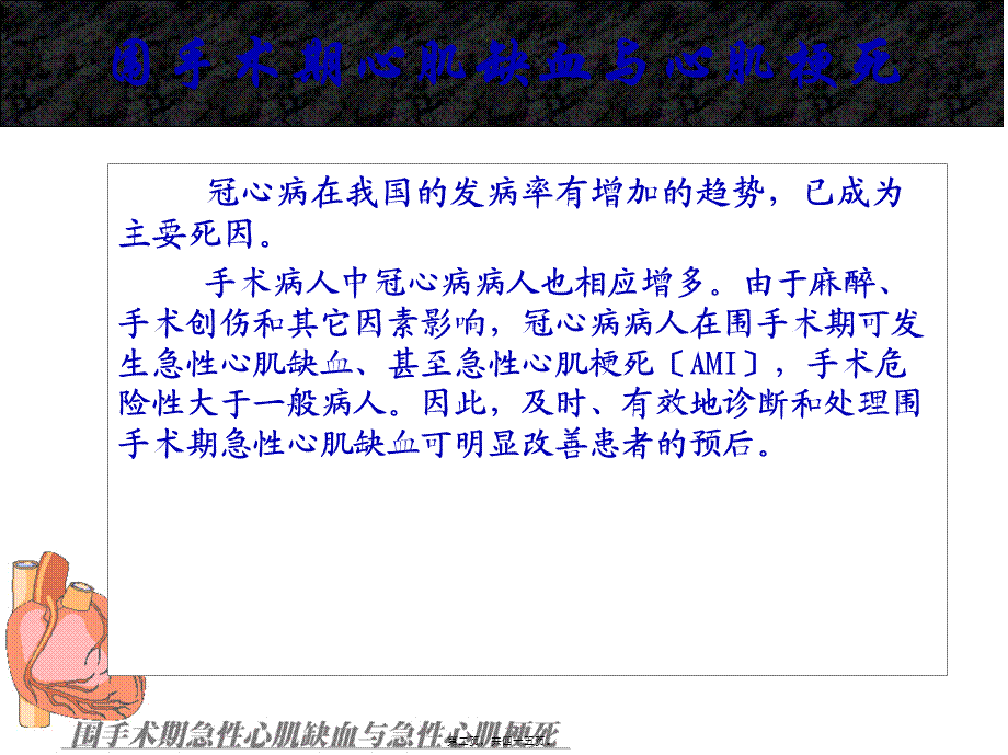 围手术期急性心肌缺血与心肌梗死(1).pptx_第2页