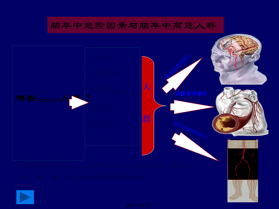 2022年医学专题—脑卒中筛查血管超声检查(1).ppt_第3页