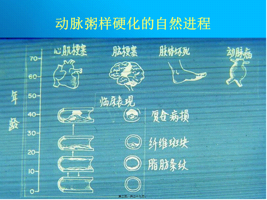 冠心病防治(1).pptx_第2页