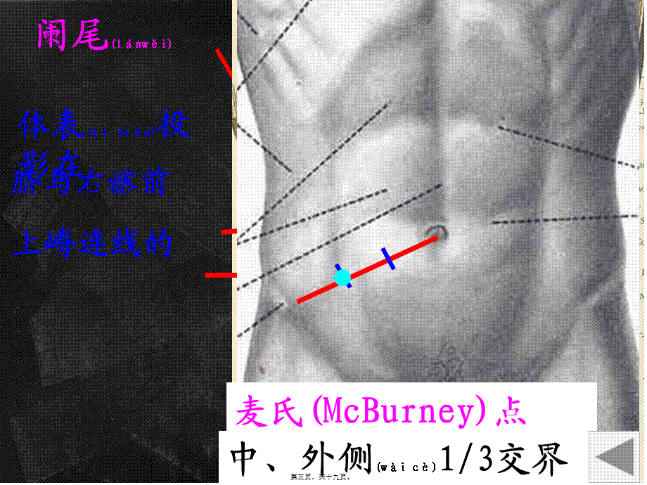 2022年医学专题—内脏测试(1).ppt_第3页