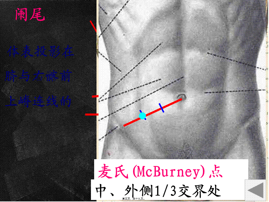 内脏测试(1).pptx_第3页