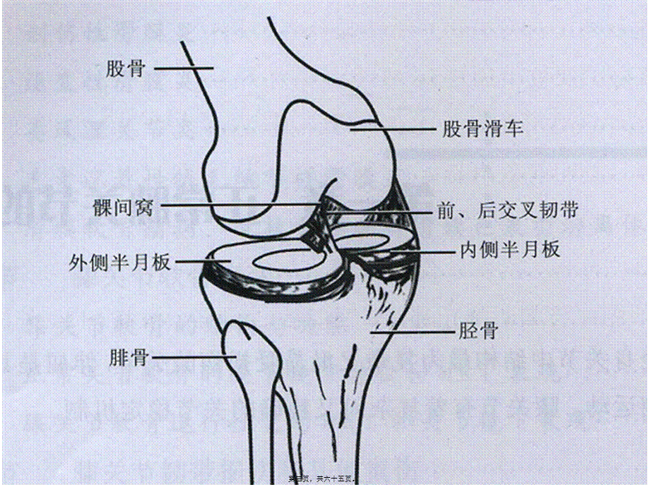 2022年医学专题—膝关节MRI读片(1).ppt_第3页