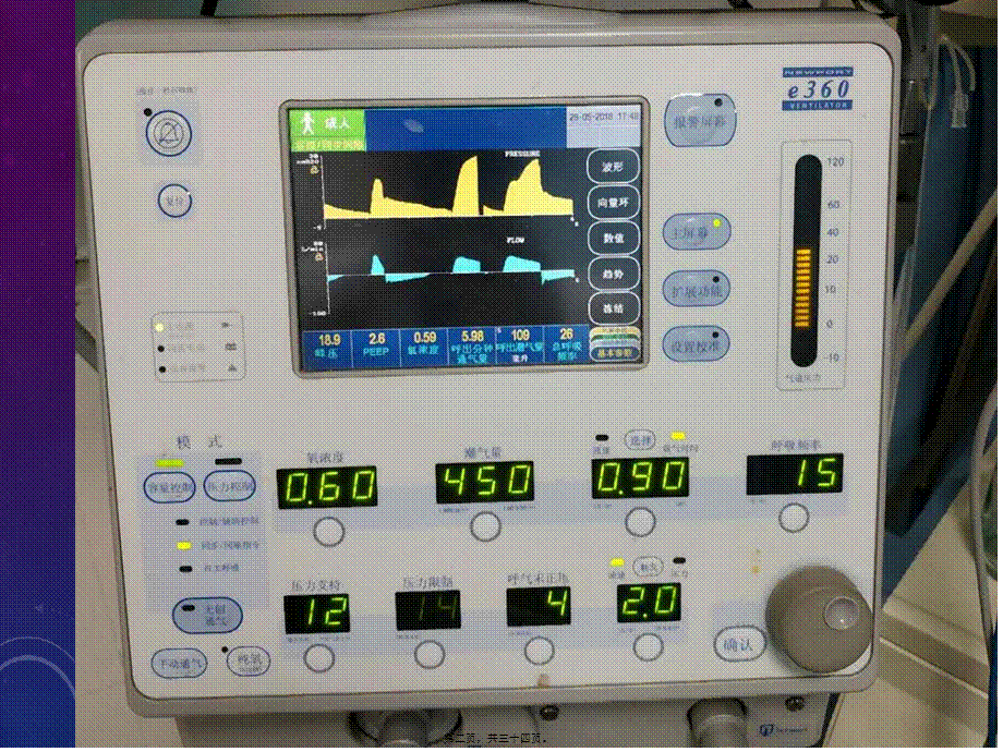 呼吸机常用模式(1).ppt_第2页