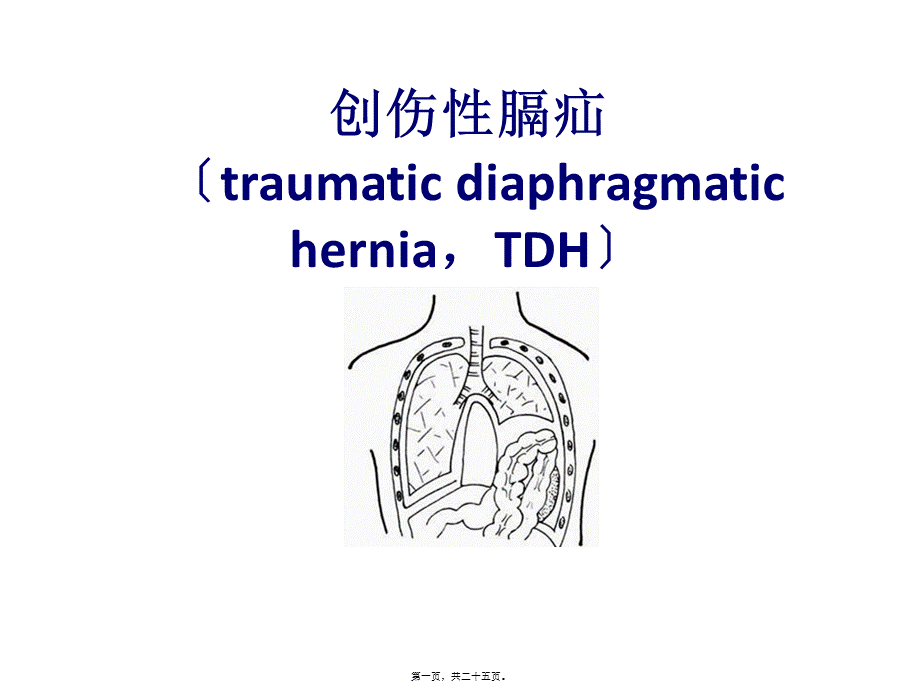 创伤性膈疝(1).ppt_第1页