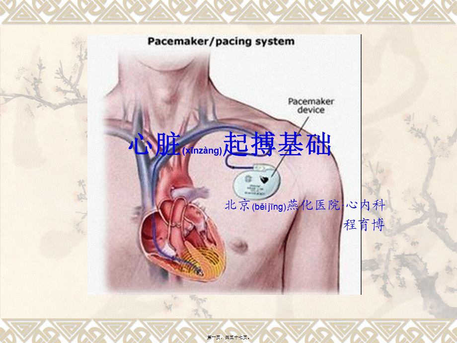 2022年医学专题—心脏起搏基础(1).ppt_第1页