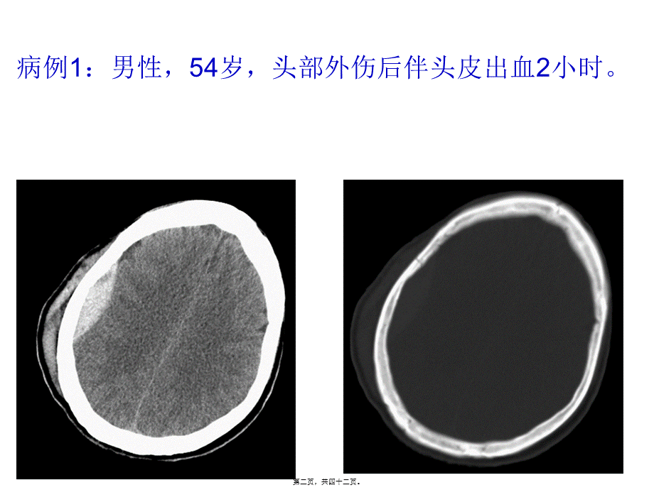 头颈部外伤病例常见病、多发病(1).pptx_第2页