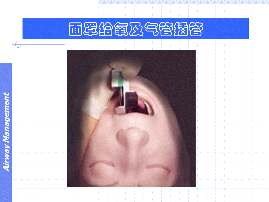 呼吸气囊和气管插管(1).ppt_第1页