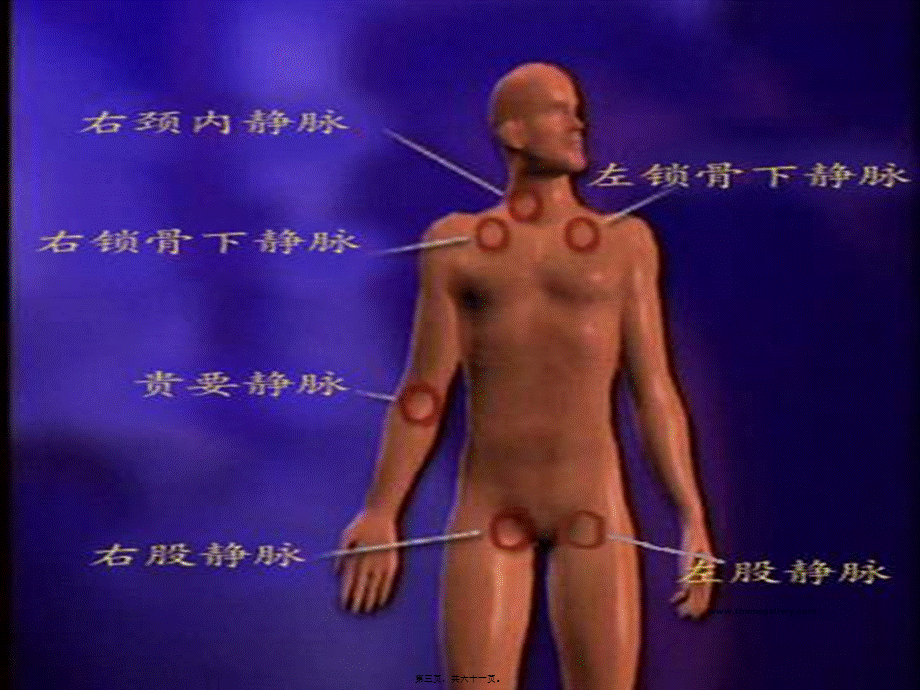 2022年医学专题—深静脉置管与PICC(1).ppt_第3页