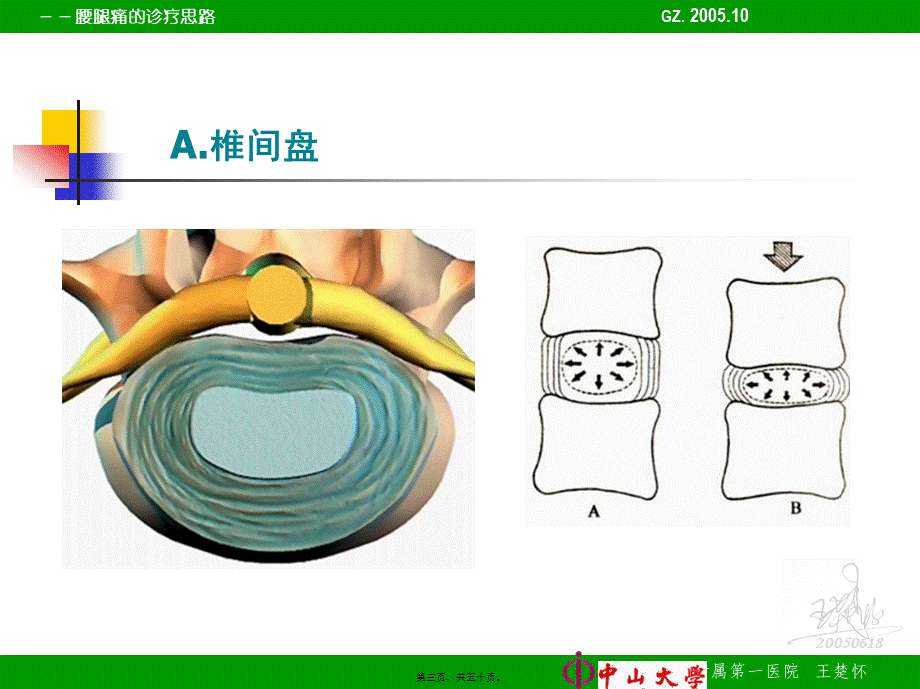 2022年医学专题—腰腿痛的诊疗思路(1).ppt_第3页