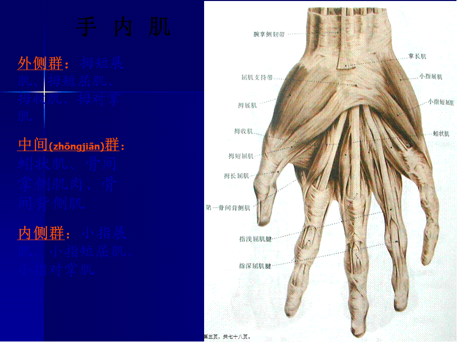 2022年医学专题—手外伤及断肢(指)再植(1).ppt_第3页