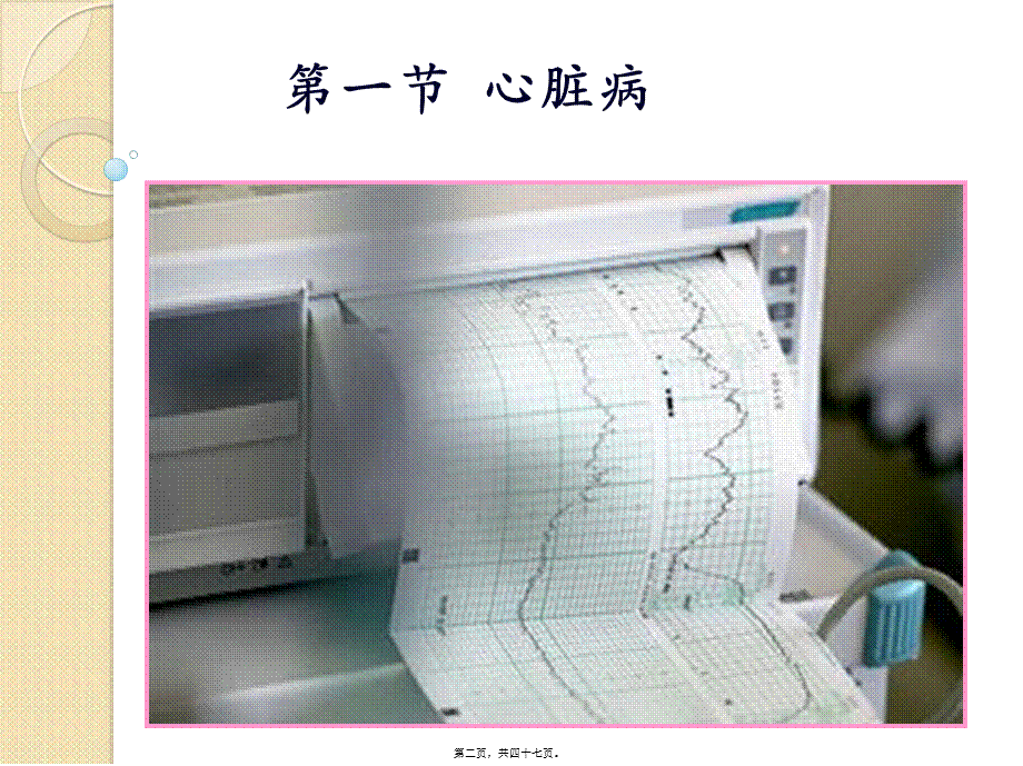 2022年医学专题—妊娠期合并症(精)(1).ppt_第2页