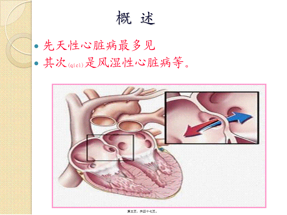 2022年医学专题—妊娠期合并症(精)(1).ppt_第3页