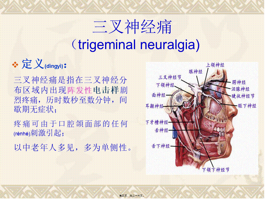 2022年医学专题—三叉神经痛-2(1).ppt_第3页