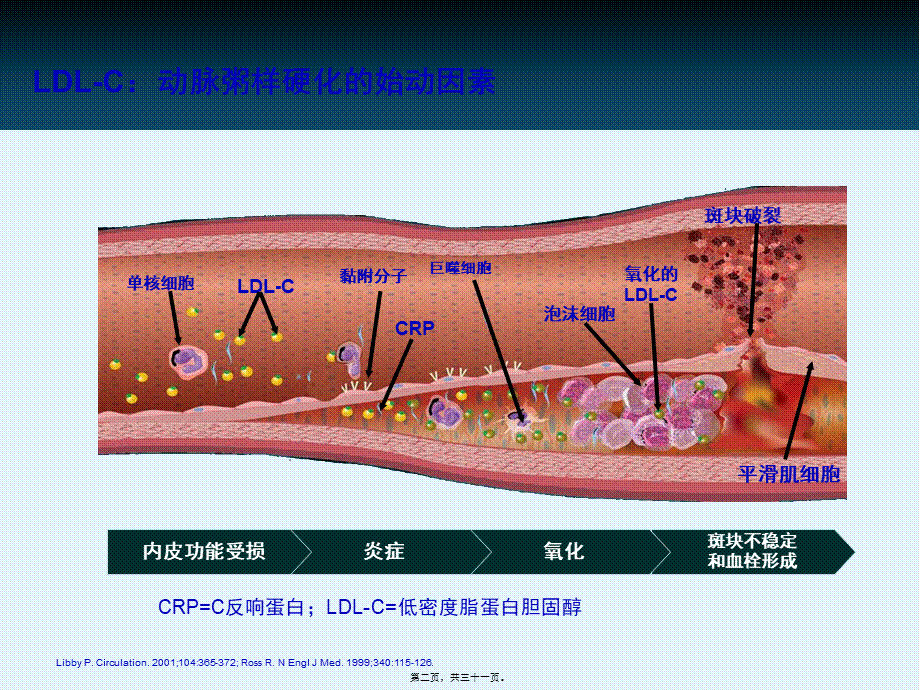 他汀在颈动脉粥样硬化中的证据(1).pptx_第2页