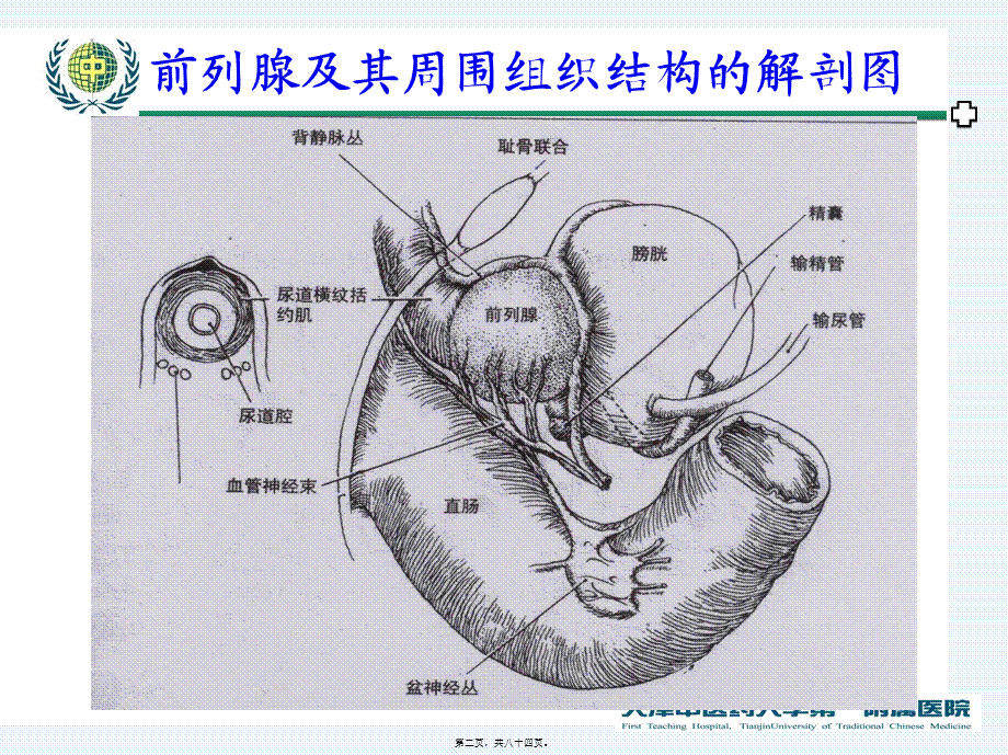 前列腺癌2014新研究概述.pptx_第2页