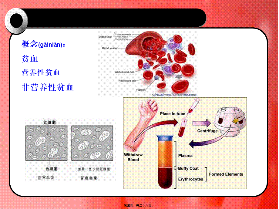 2022年医学专题—第二十三章改善营养性贫血的功能性食品.ppt_第3页