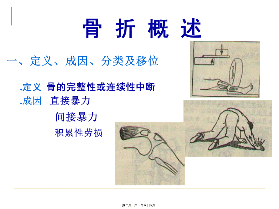 可出现前臂骨筋膜室综合征.pptx_第2页