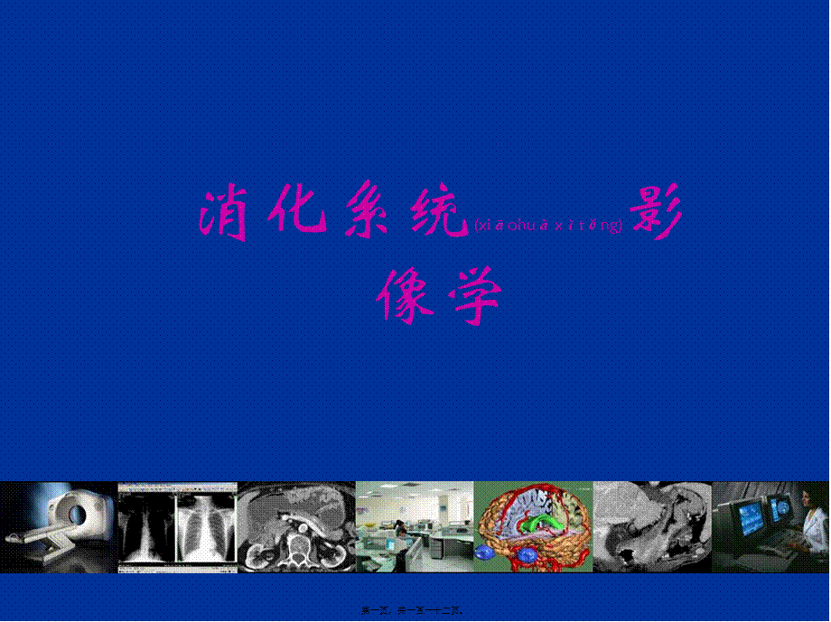 2022年医学专题—胃肠道CT检查-影像FTP(1).ppt_第1页