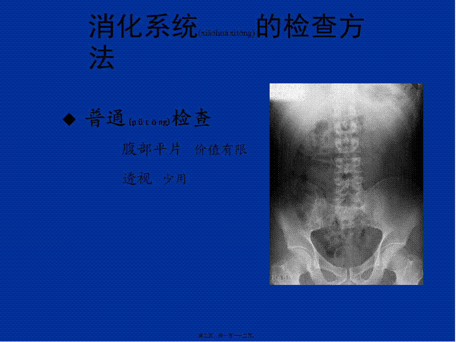 2022年医学专题—胃肠道CT检查-影像FTP(1).ppt_第2页