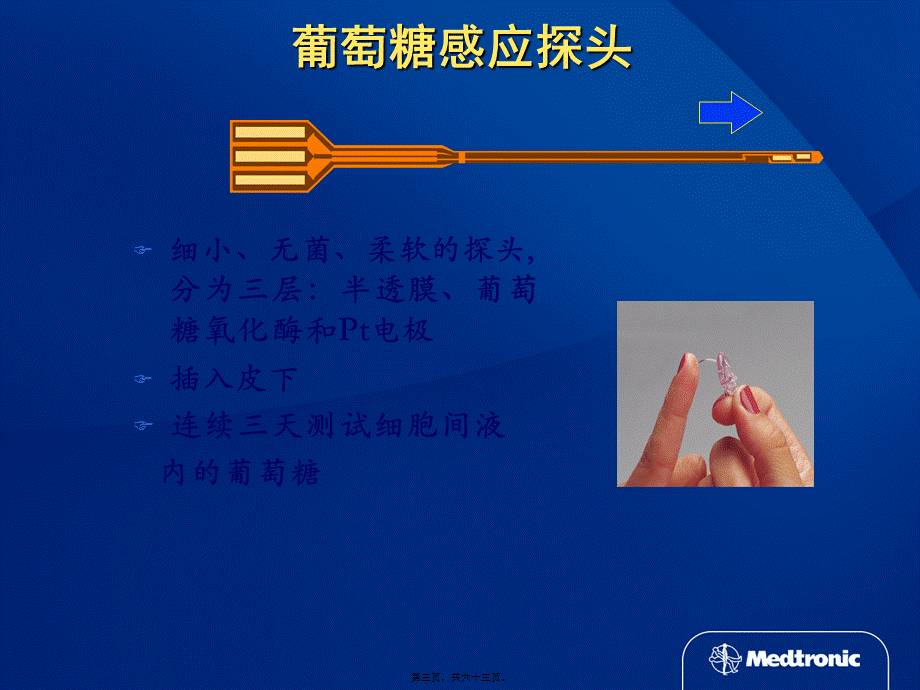 动态血糖仪及未来展望.pptx_第3页