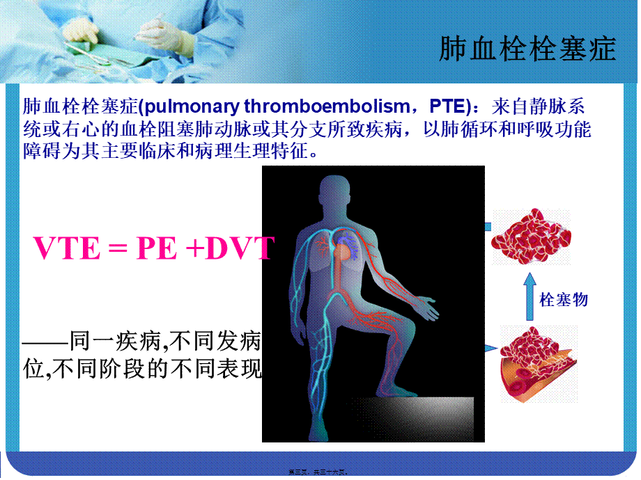 大面积肺栓塞与急性右心功能不全.pptx_第3页