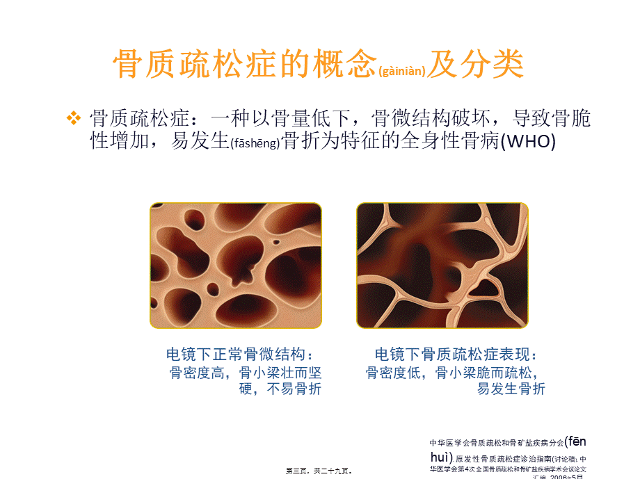 2022年医学专题—糖皮质激素性骨质疏松症.ppt_第3页