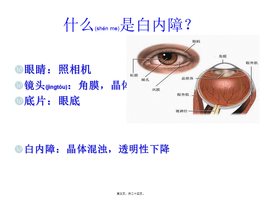 2022年医学专题—白内障(1).ppt_第3页