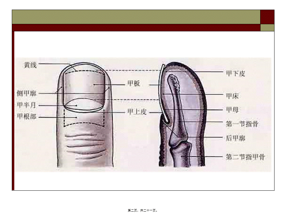 2022年医学专题—手化脓性感染(1).ppt_第2页