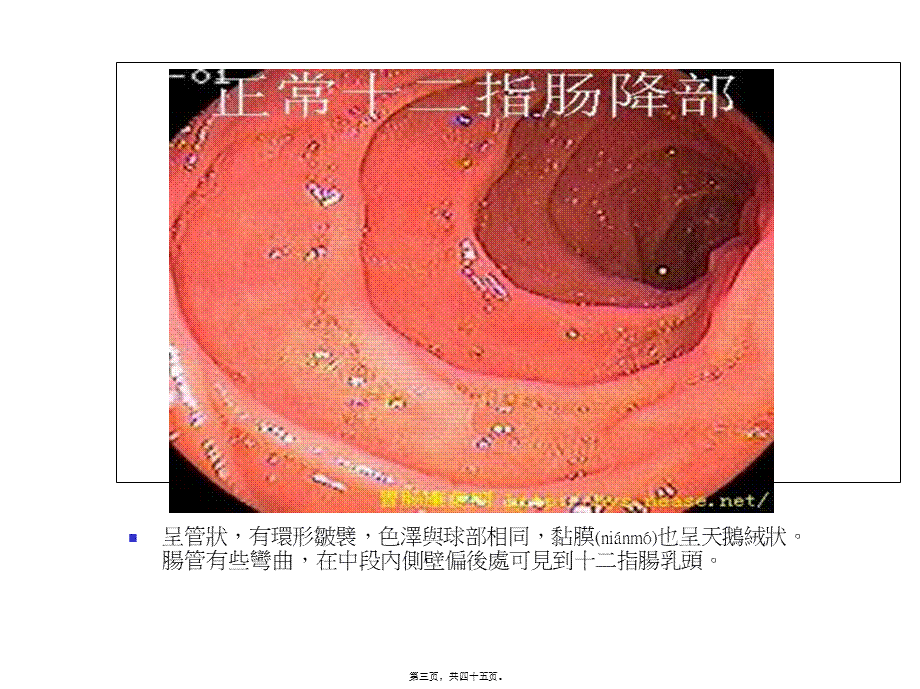 2022年医学专题—胃与十二指肠溃疡病的.ppt_第3页