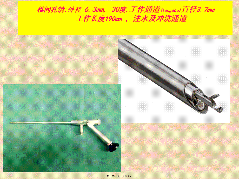 2022年医学专题—腰椎间盘突出症行椎间孔镜.ppt_第3页