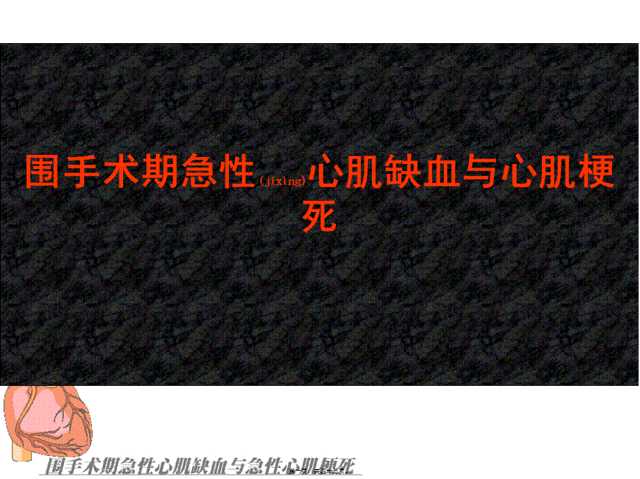 2022年医学专题—围手术期急性心肌缺血与心肌梗死(1).ppt_第1页