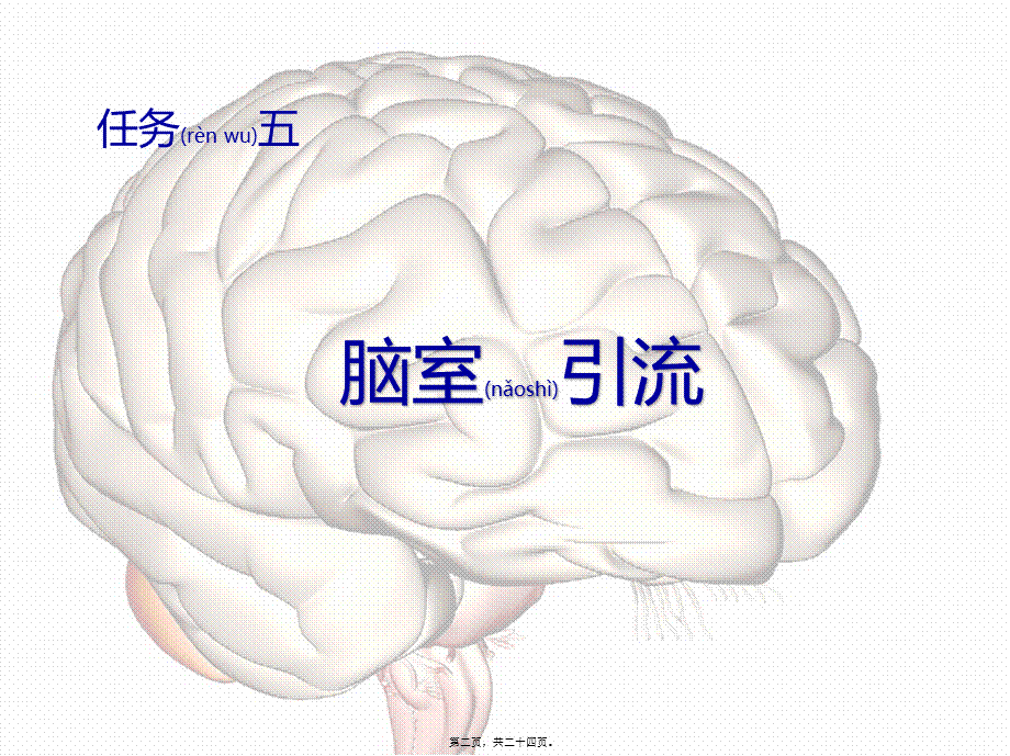 2022年医学专题—脑室引流(1).pptx_第2页