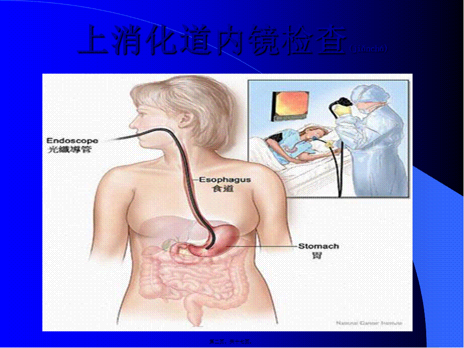 2022年医学专题—胃肠镜检查前后注意事项.ppt_第2页