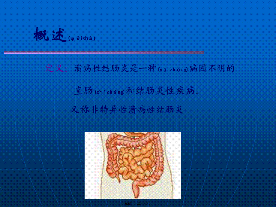 2022年医学专题—溃疡性结肠炎.ppt_第3页